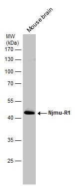 C17orf75 antibody [N1C1]