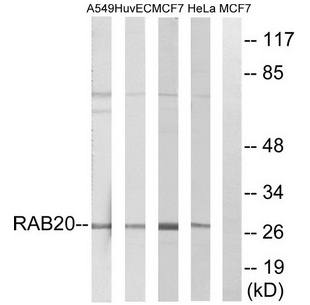 RAB20 antibody