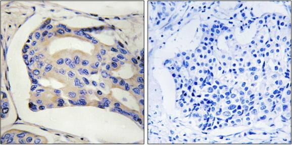 STK32C Antibody