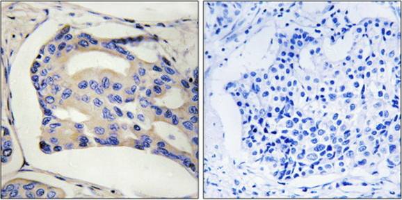 STK32C antibody