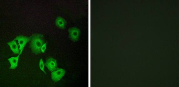 TTF2 Antibody