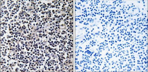 TACC3 antibody