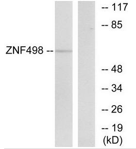 ZNF498 Antibody