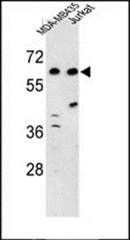 C19orf26 antibody
