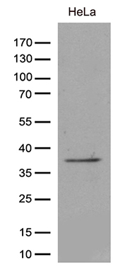 C19orf80 Antibody