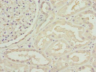 C1GALT1C1 Antibody