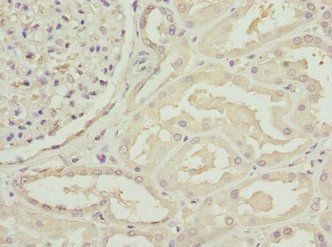 C1GALT1C1 antibody