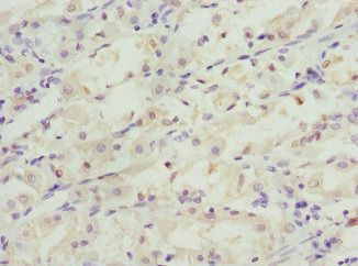 C1GALT1C1 Antibody