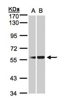 C1INH antibody
