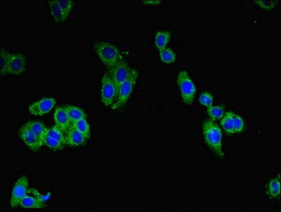 CATSPERE Antibody