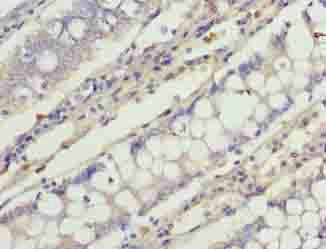 C1orf101 antibody