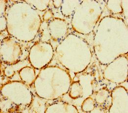 C1orf112 Antibody