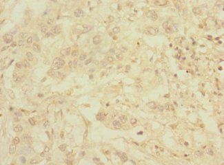 C1orf127 Antibody
