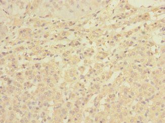 C1orf127 Antibody