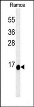 C1orf186 antibody