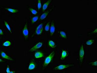 C1orf189 Antibody
