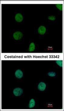 C1orf57 Rabbit Polyclonal Antibody