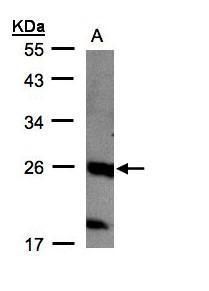C1orf57 Rabbit Polyclonal Antibody