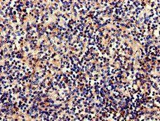 C1QA Antibody