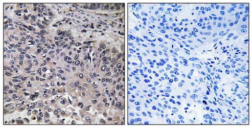 C1QC Antibody