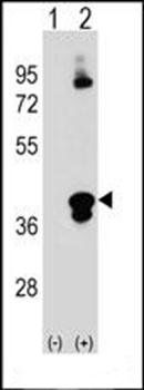 C1QTNF1 antibody