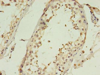 C1QTNF6 Antibody