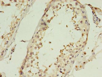 C1QTNF6 antibody