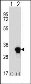 C1QTNF6 antibody