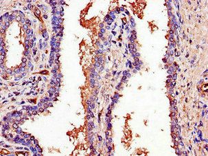 PCOTH Antibody