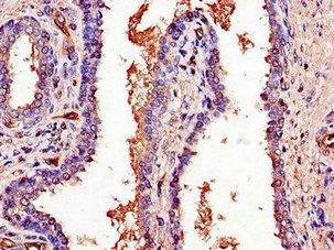 C1QTNF9B-AS1 antibody