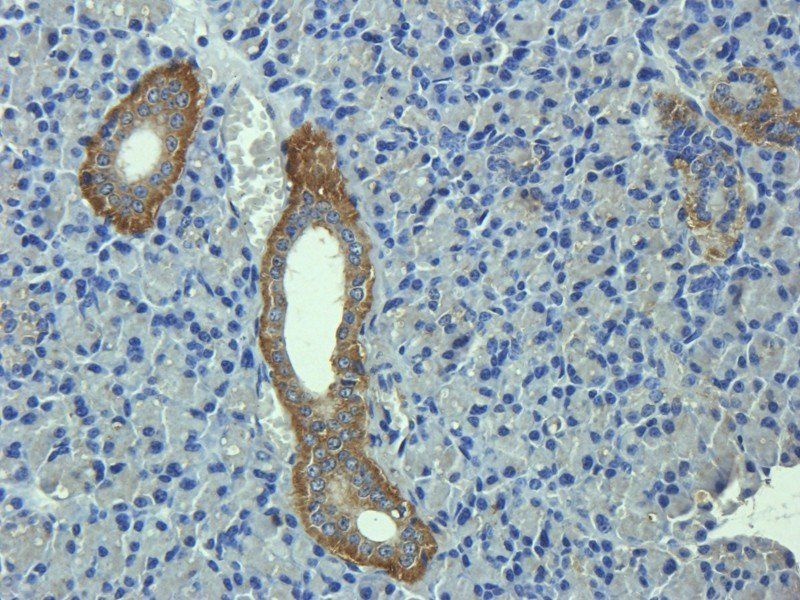 C1R antibody