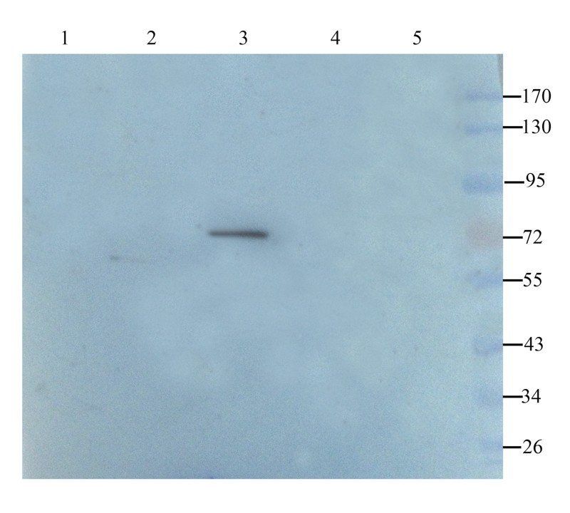 C1R antibody