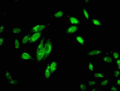 C1R Antibody