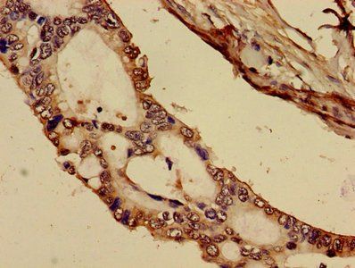 C1R Antibody