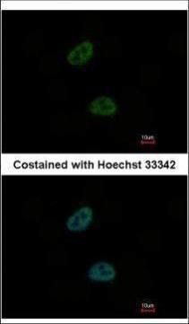 C20orf11 antibody [N1C3]