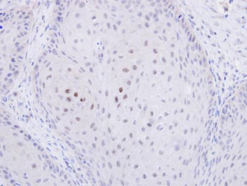 C20orf11 antibody [N1C3]