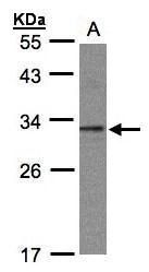 C20orf11 antibody [N1C3]