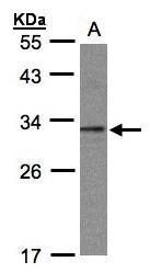 C20orf11 antibody