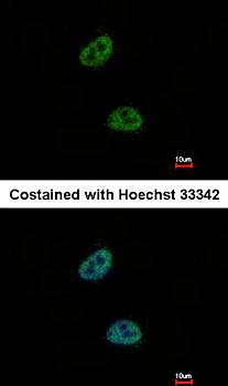 C20orf11 Rabbit Polyclonal Antibody