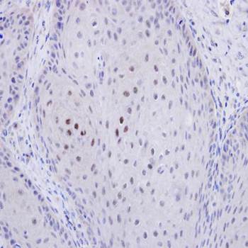 C20orf11 Rabbit Polyclonal Antibody
