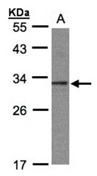 C20orf11 Rabbit Polyclonal Antibody