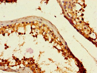 C2CD3 Antibody