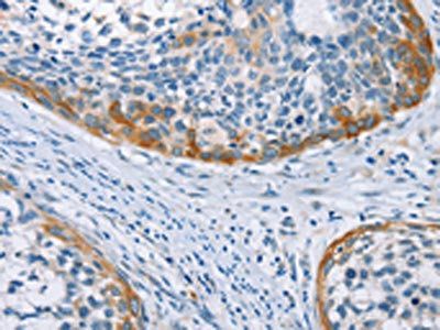 C3AR1 Antibody