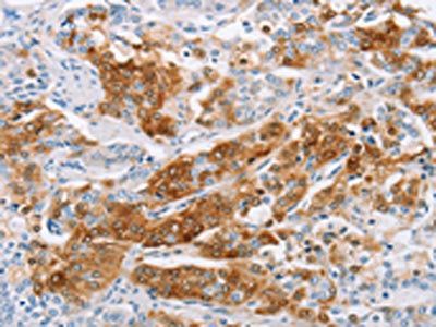 C3AR1 Antibody