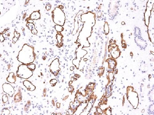 Complement 4d (C4d) (Acute Humoral Rejection Marker) Antibody