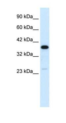 C4BPB antibody