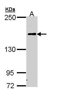 complement C5 Antibody