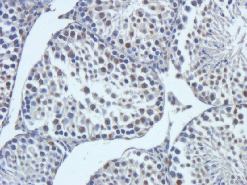 C5a antibody