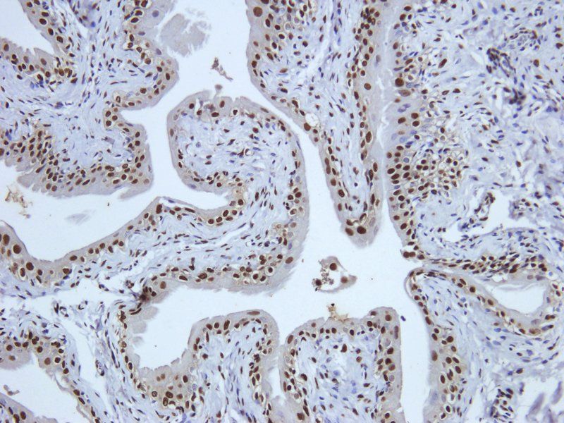 C5a antibody