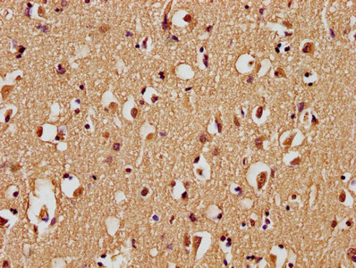 C5AR2 Antibody
